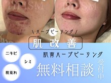 ネムレル森(Nemureru森)