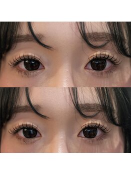 ビューティマーケット アングゥ(BEAUTY MARKET ungu)/人気デザイン