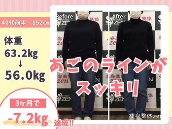 ゼン(zen)/痩身ダイエット整体