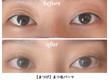 ヴィラアンドテラス(Villa×terrace)/マツパ