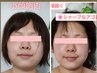 ★水流し小顔矯正★【左右差、歪み、エラハリ小顔】気になるパーツを改善♪