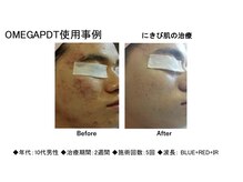 シュシュ(chou chou)の雰囲気（全てのお客様のお肌トラブルを解決します★）