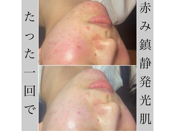 ブラックボックス(BLACK BOX)/20代女性のお客様