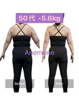 アネモネ/ダイエット/痩身/耳つぼ/腸活