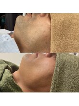 トリップ(trip)/若見え！髭脱毛