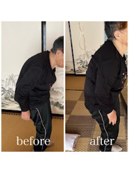 一関整体院/姿勢の改善実績