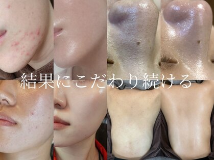 フォア(foi)の写真