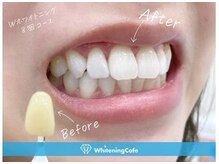 ホワイトニングカフェ 中野店(WhiteningCafe)の雰囲気（ホワイトニングの症例写真はフォトギャラリーをCheck！中野店）