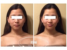 美極 銀座店/銀座/小顔コルギ/小顔矯正