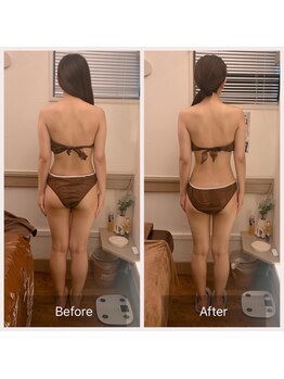 カルナ(carna)/《3か月計6回》2週間に1回