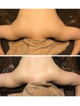 リアン(凛晏)/ビフォーアフター