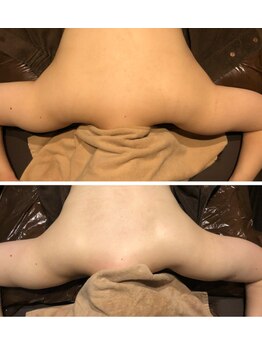 リアン(凛晏)/ビフォーアフター