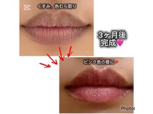 リア(Li'a.)/THEMELANIN唇【愛知県初】