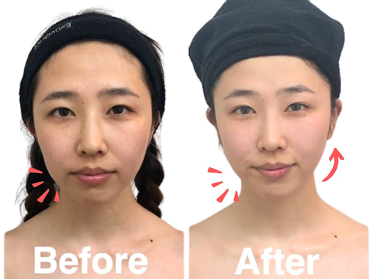 小顔フェイスラボ 馬車道店(小顔 Face Labo.)｜ホットペッパービューティー