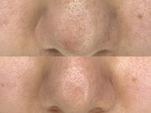 ライリー(Rairy)/スッキリ毛穴洗浄♪