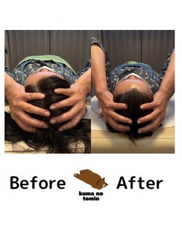 クマの冬眠 高知店/エラ張り、食い縛り