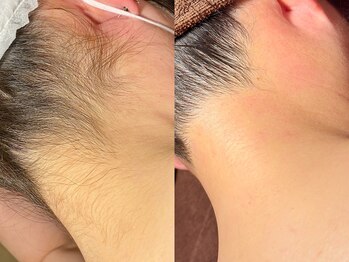 ルーナジェーナ(Luna llena)/池袋　エステ　ルーナジェーナ