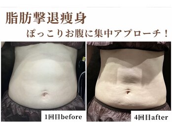 シン(Shin)/ぽっこりお腹に♪