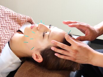 ワンドア(ONEDOOR)/【美容鍼】食いしばり/くすみ