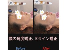 美容矯正サロン レレポノ(LELEPONO)/