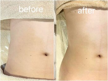 サロン ド ブラン アオヤマ(Salon de BLANC AOYAMA)/腸もみmassage