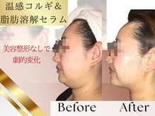 クイーンズ ピュア 恵比寿店(Queen's Pure)/クイーンズピュア式コルギ