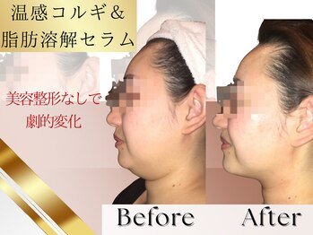 クイーンズ ピュア 恵比寿店(Queen's Pure)/クイーンズピュア式コルギ