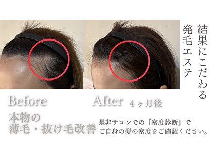 サロンチョコ(salon choco)の写真