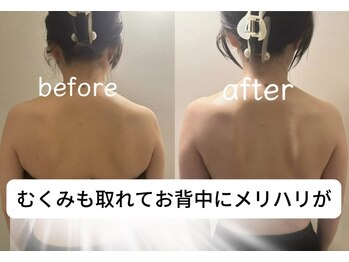 アジオ 三ノ宮駅前店(AGIO)の写真/【花嫁様必見】鏡を見るのが楽しくなる理想の美シルエット!小顔もお任せ!思わず振り返られる綺麗な姿へ◎