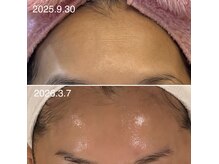 ル ソアン 六甲道(Le soin)