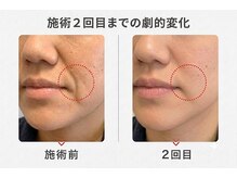 りんぱサロン まり