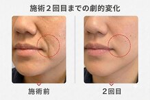 りんぱサロン まり