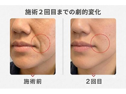 りんぱサロン まりの写真