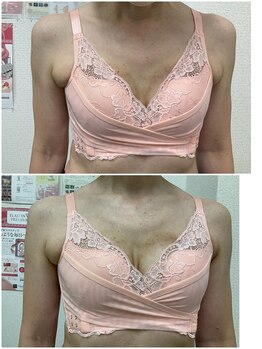 バーディー(BIRDIE)/施術1回/50代