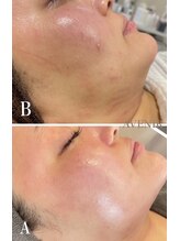 アベニール 芦屋/乾燥に負けない潤い肌に