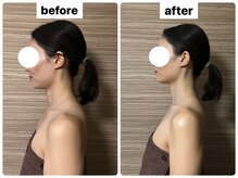 ライズサロン(RiseSALON)/オールハンドリンパマッサージ