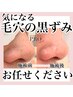 【黒ずみ・いちご鼻】毛穴改善コース☆デコルテorヘッドマッサージ付♪90分