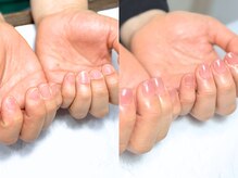 ナチュリア(Natulea)/一瞬で手の印象が変わる♪