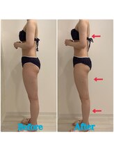 スペチアーレ 夙川/夏に向けて美ボディに