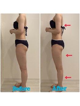 スペチアーレ 夙川/夏に向けて美ボディに