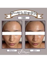 ビーマジック(美magic)/サーマトリックス