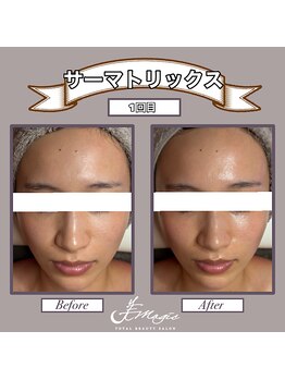 ビーマジック(美magic)/サーマトリックス