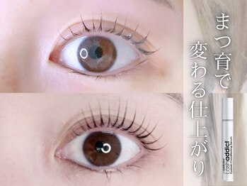 アイアンドネイル ブライト(bright)/まつげ監理もお任せ☆