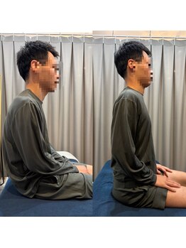 かわさき整体院/1回でこんなに姿勢が変わる
