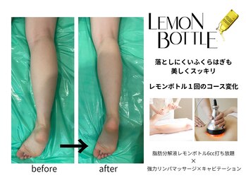 クリニカルエステ イーズ 小倉リバーウォーク北九州デコシティ店/BODYレモンボトル変化写真-3