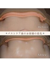 プライベートエステ カモミール/バザルトバストケア(o＾・＾o)