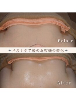 プライベートエステ カモミール/バザルトバストケア(o＾・＾o)