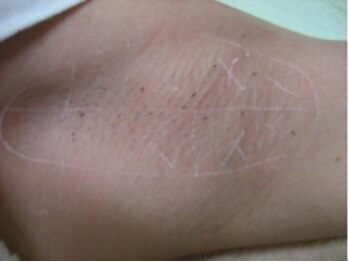 レイジア デイスパ 松本(DaySpa)/しっかり施術漏れチェック