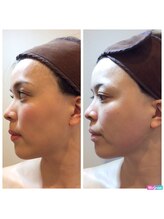 ミエル(Miel)/Before　after