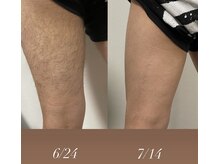 ミーミドットアイ(Mi-mi.i)/1度でこの効果！